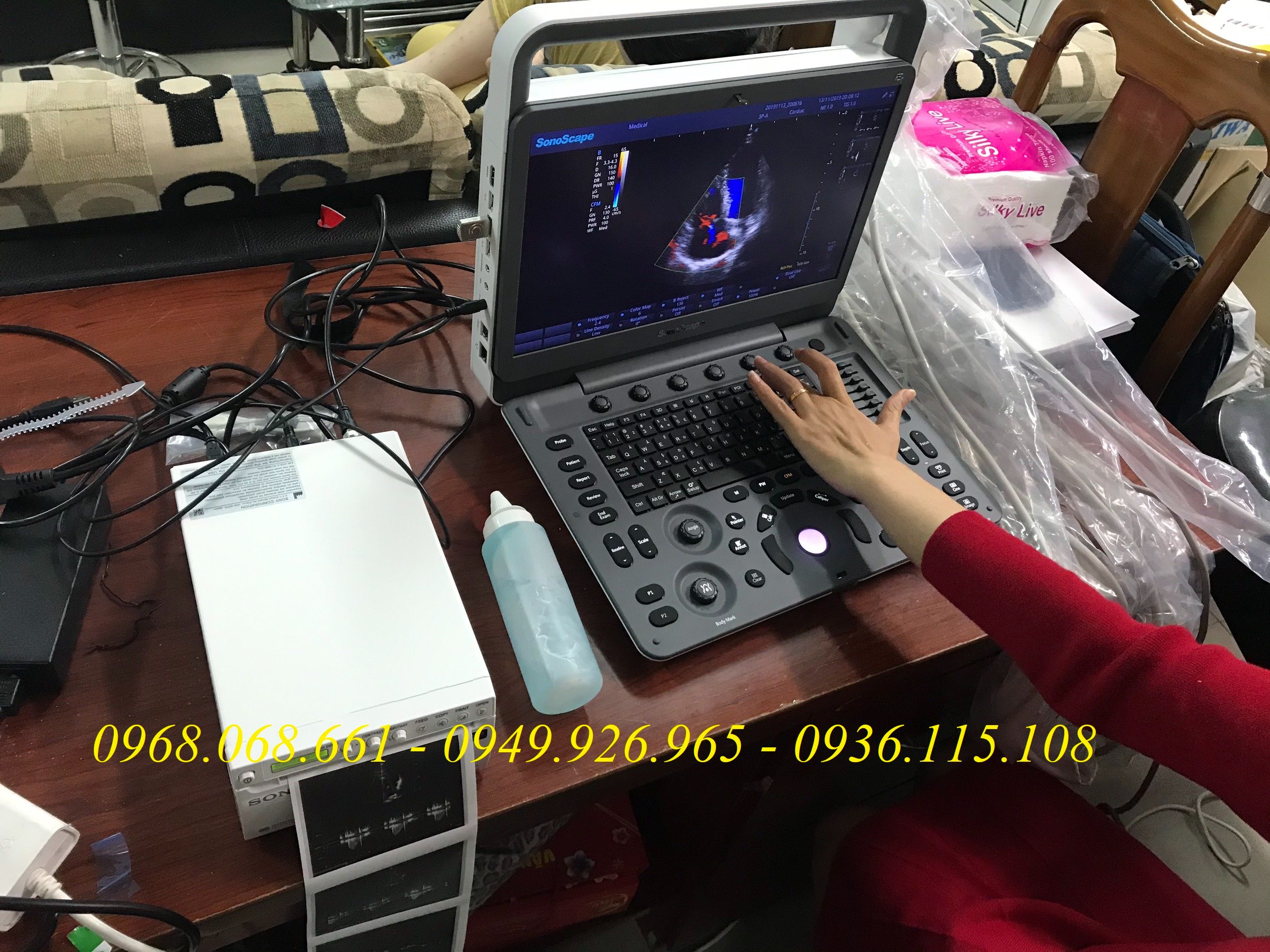 Top 7 máy siêu âm xách tay chất lượng - giá dưới 100 triệu Tại Y Tế Hoàn Mỹ